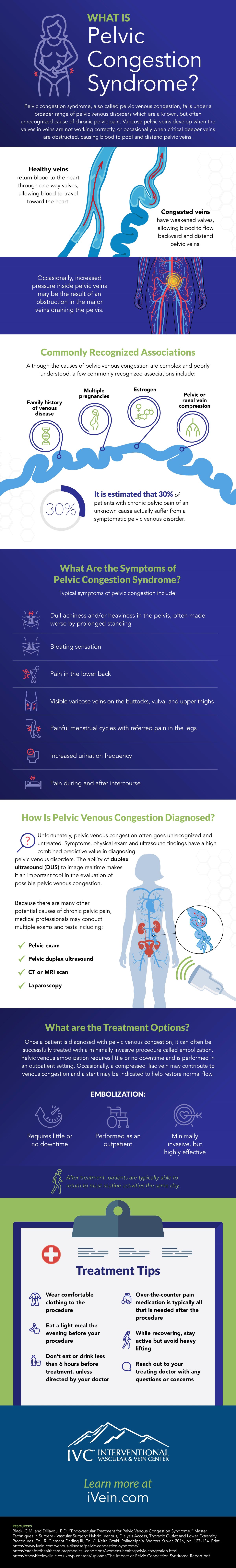 infographic describing the diagnosis and treatment of pelvic congestion syndrome