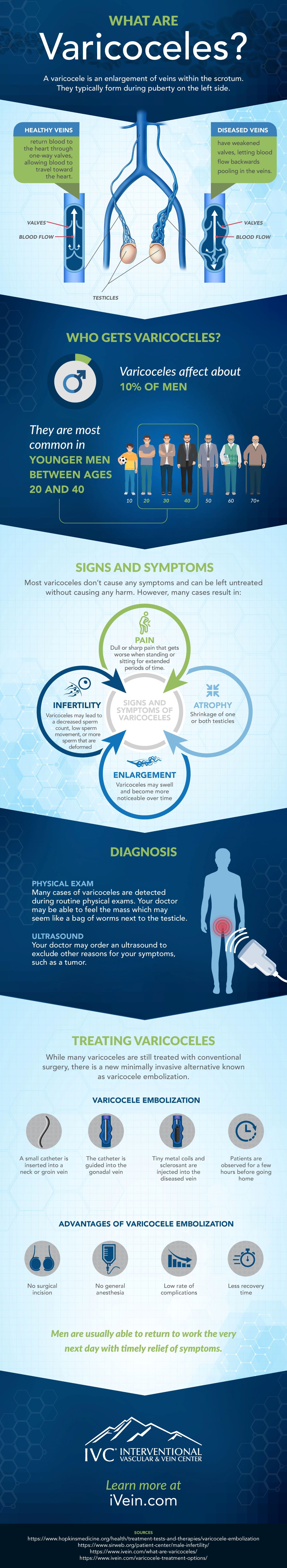 infographic describing the diagnosis and treatment of varicoceles