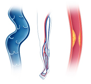 veins and arteries in the lower extremity