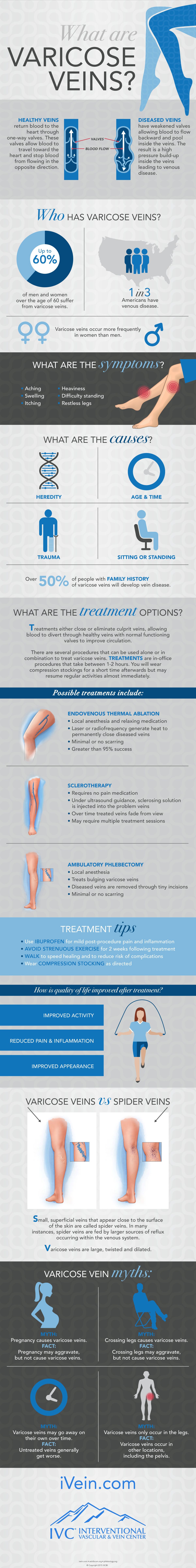 infographic describing the diagnosis and treatment of varicose veins