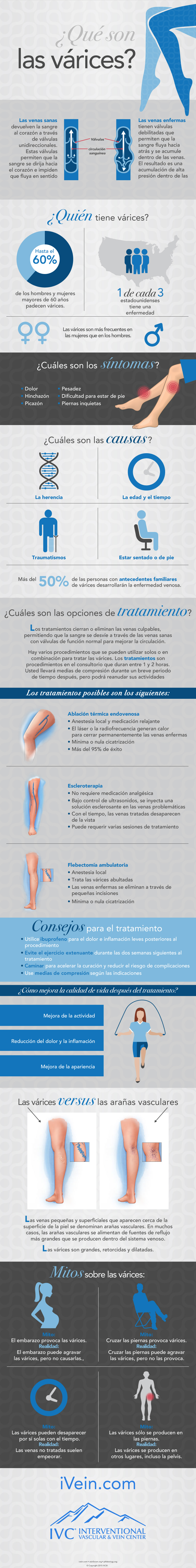 Qué son las venas varicosas infografía