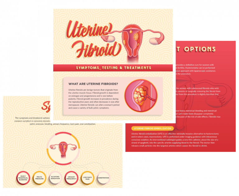 preview of uterine fibroid infographic