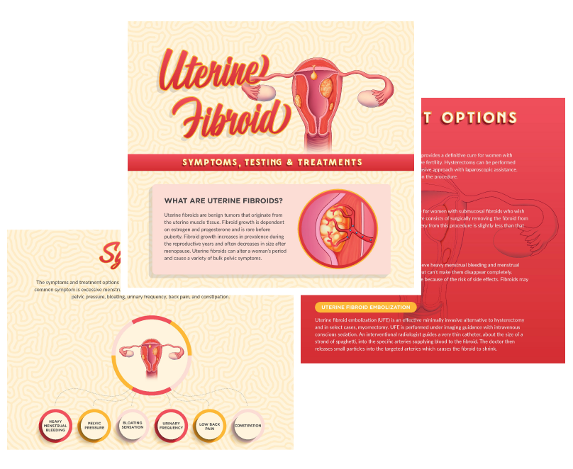 Uterine Fibroid Treatment IVC