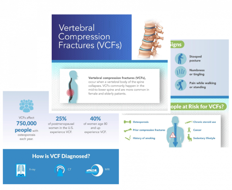 Preview images of vertebral compression fractures infographic