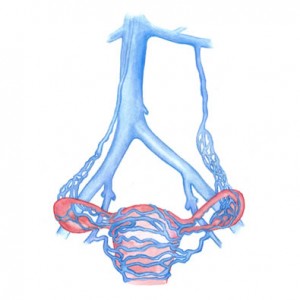 Pelvic venous insufficiency at IVC Interventional and Vein Center