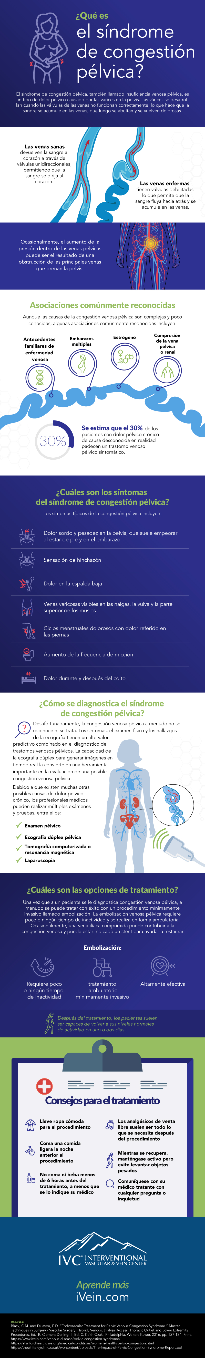 infografía del síndrome de congestión pélvica